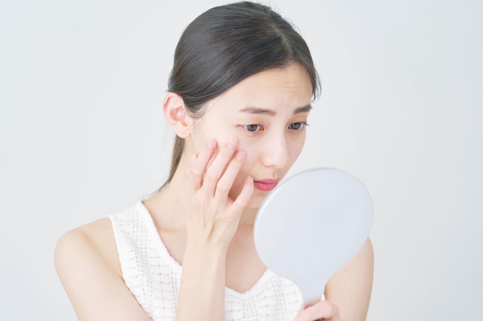 シミ取りレーザーとは?