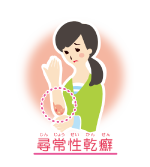 尋常性乾癬