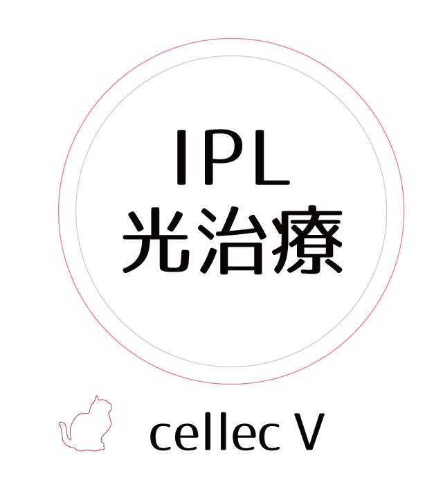 IPL光治療